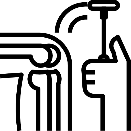 Joint Replacement Surgery