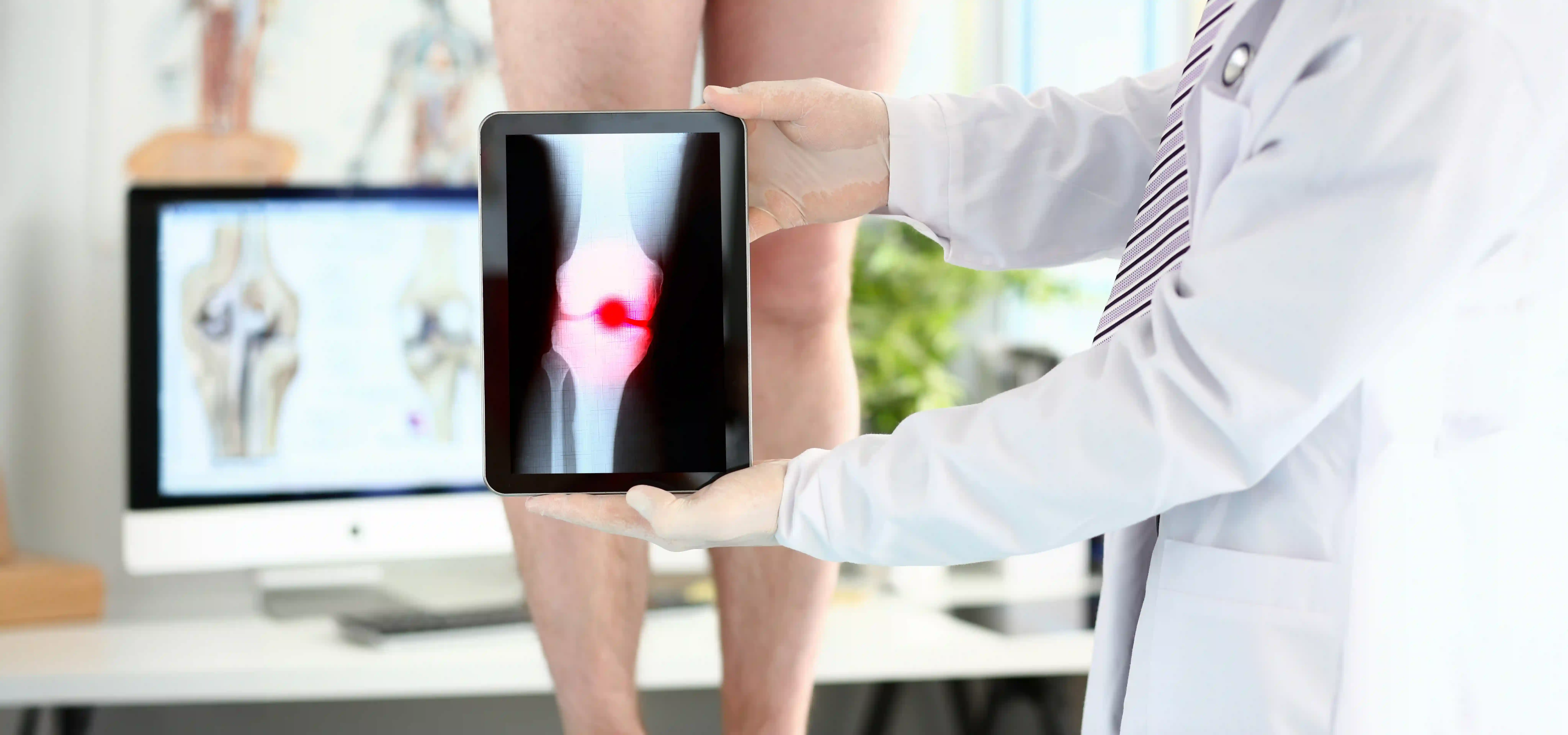 Bone Tumours & Musculoskeletal Oncology