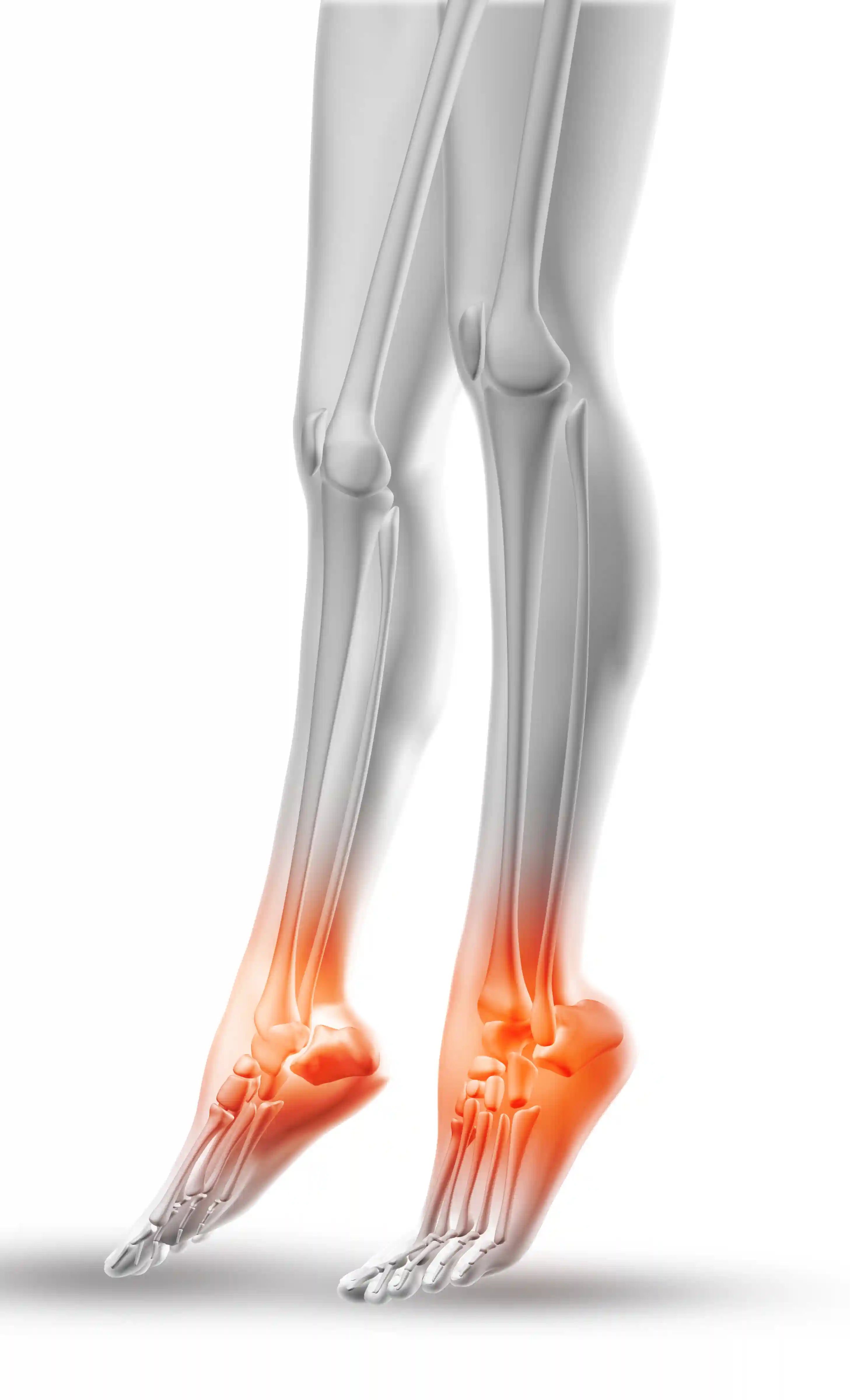 Ankle Instability
