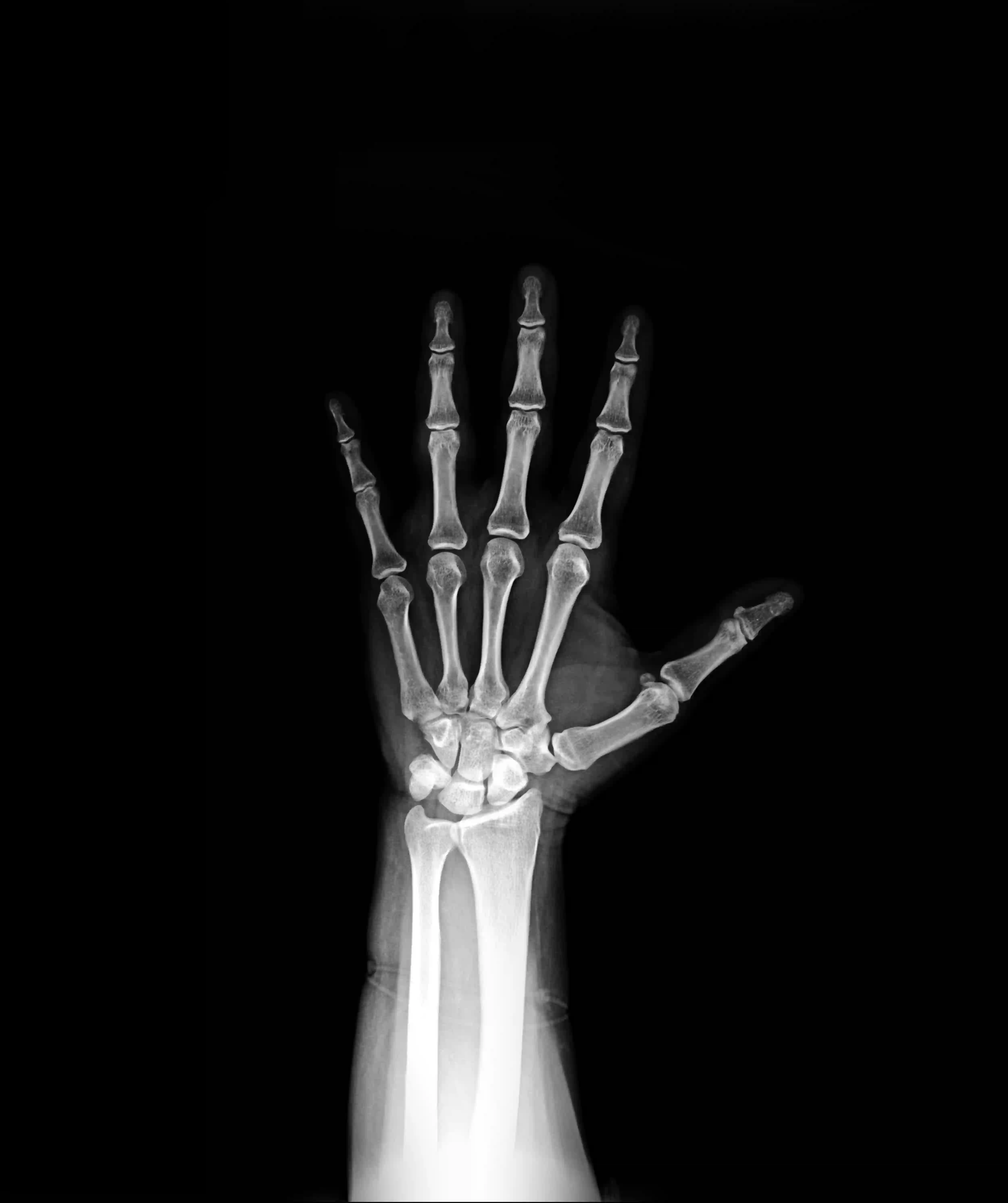 Hand Trauma