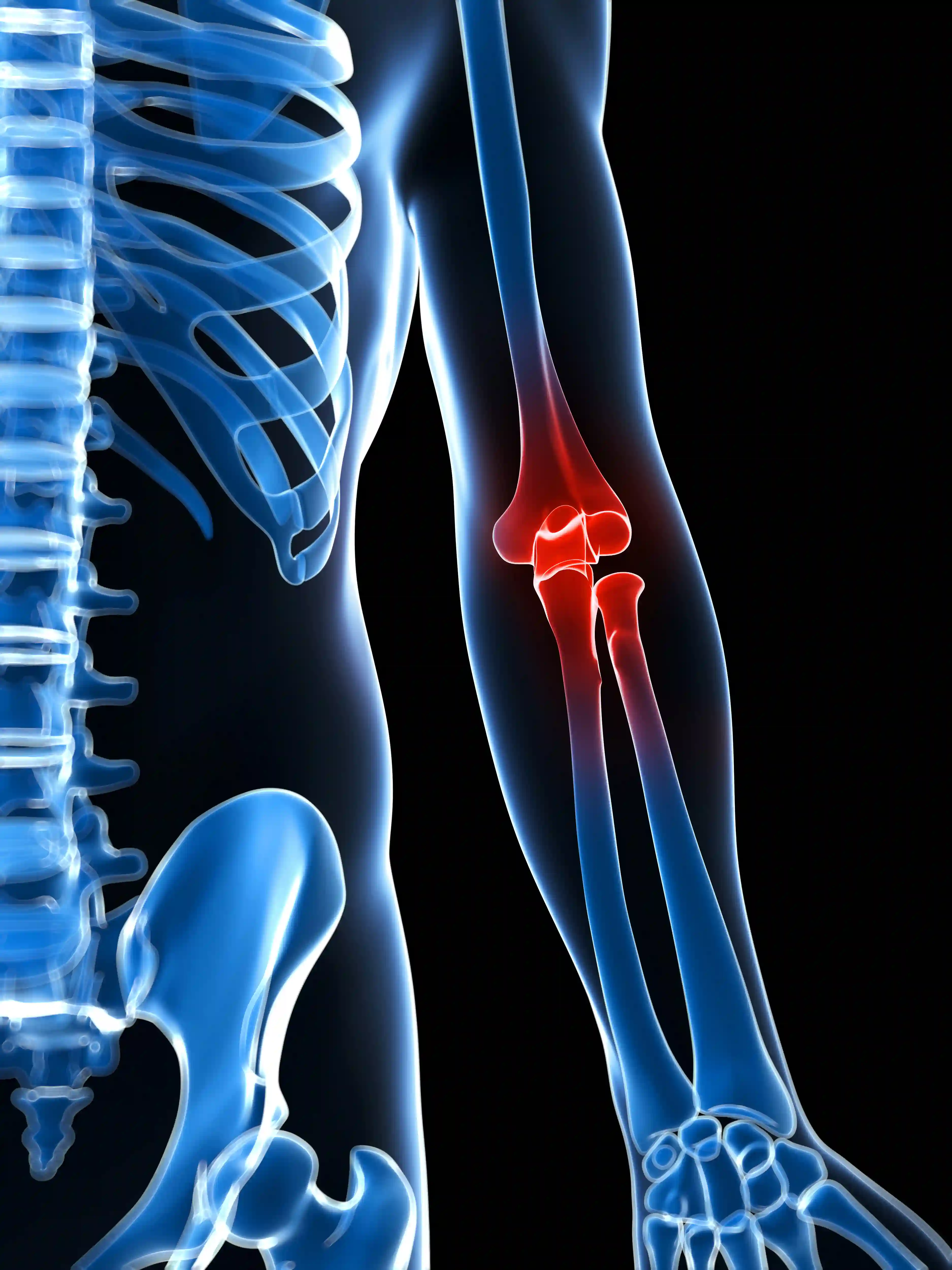 Tendon Injuries