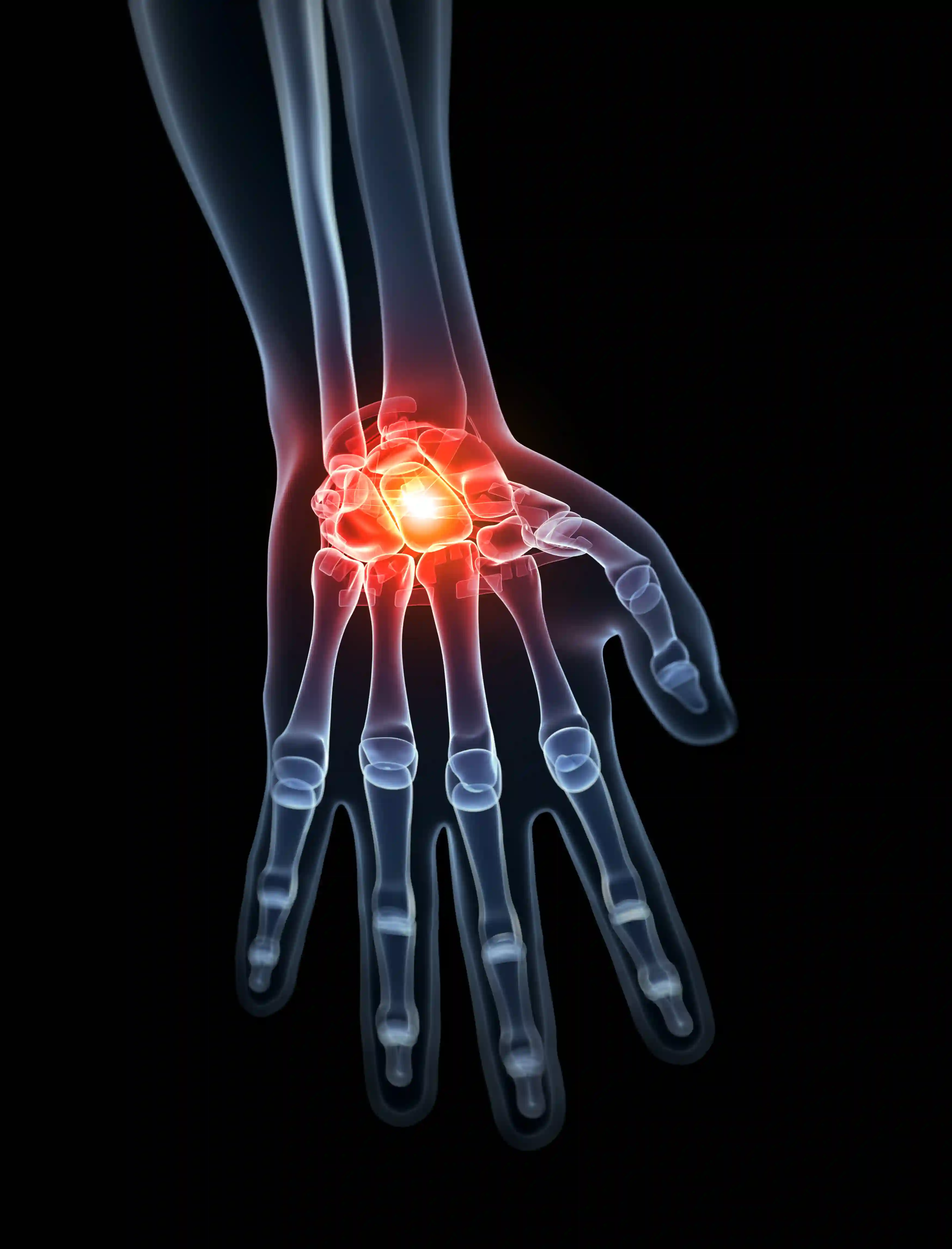 Wrist Injuries