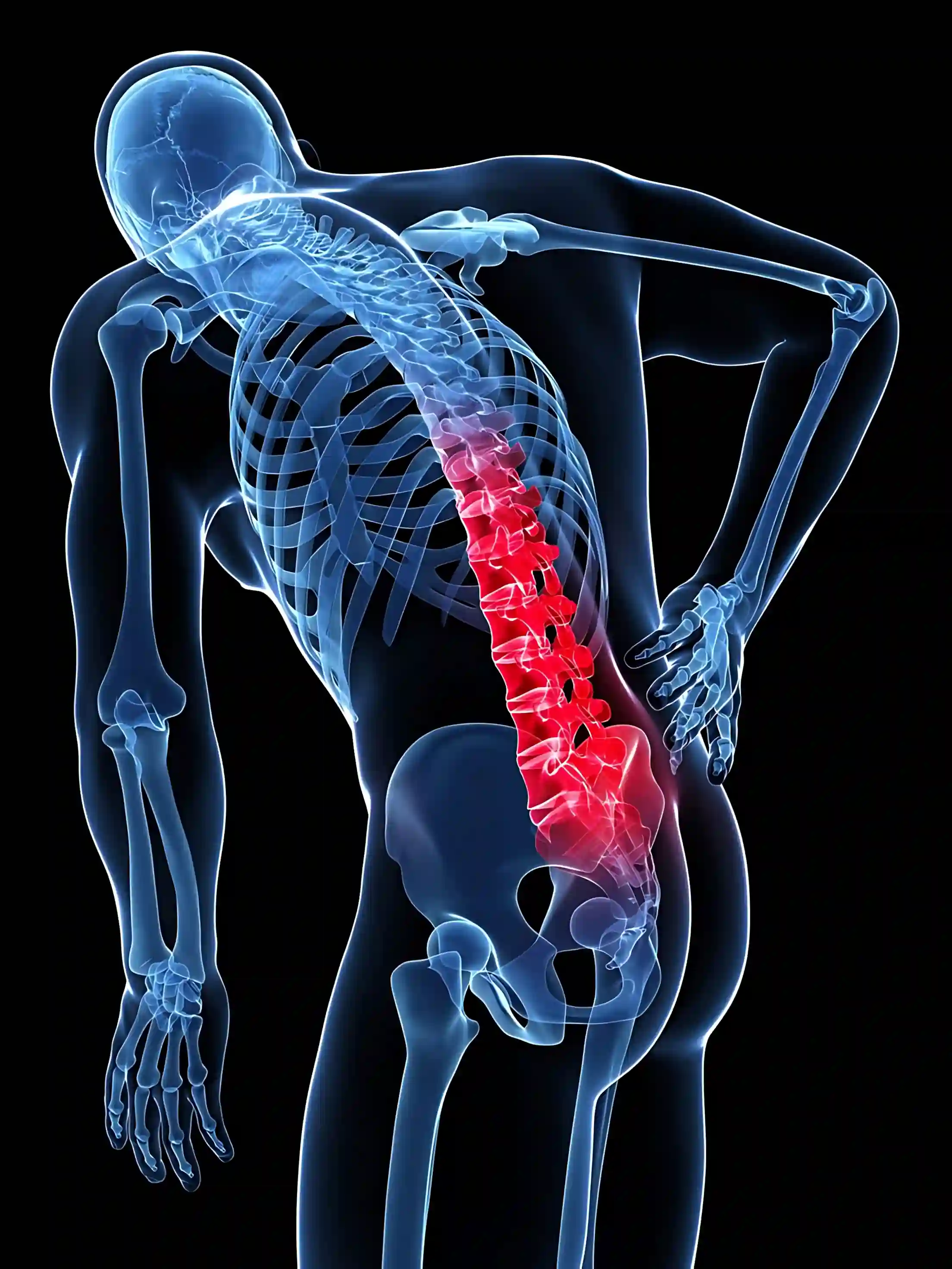 Sciatica Treatment