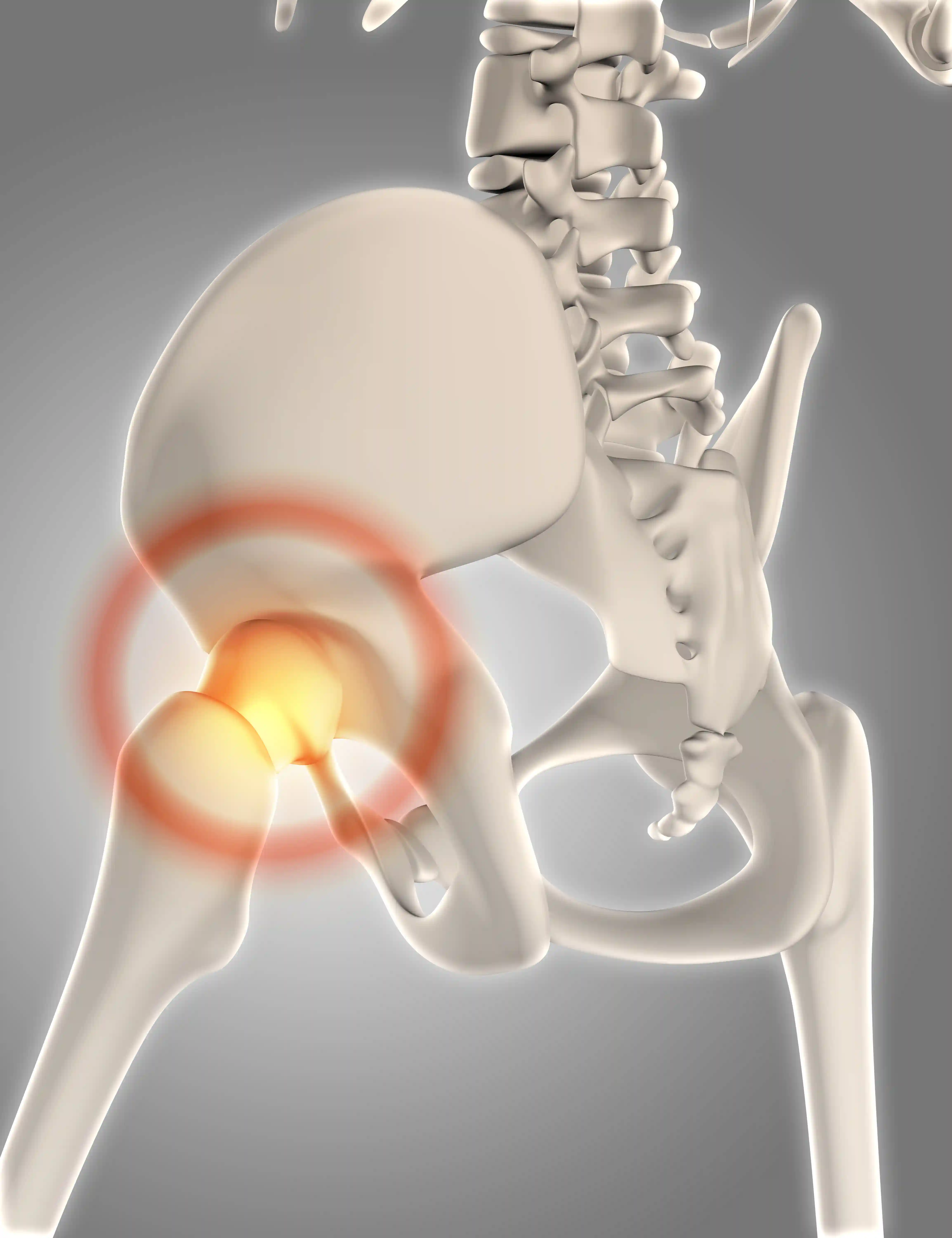 Pelvic & Acetabular Trauma